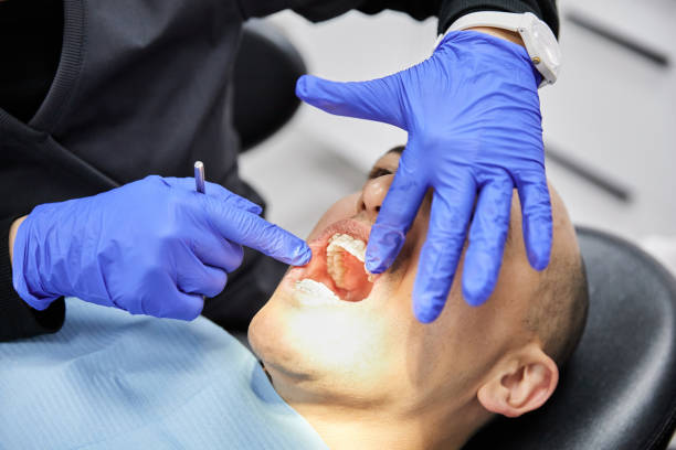 Best Emergency Treatment for Oral Infections in Krum, TX
