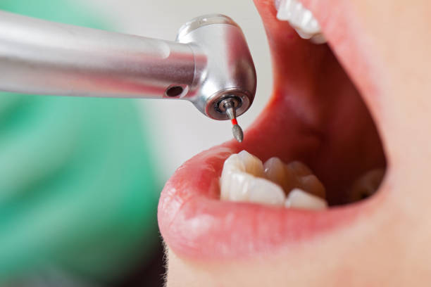 Best Emergency Denture Repair in Krum, TX